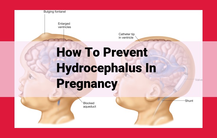 Preventing Hydrocephalus During Pregnancy: Essential Precautionary Measures